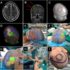 Real‐time augmented reality application in presurgical planning and lesion scalp localization by a smartphone - Neurosurgery Blog