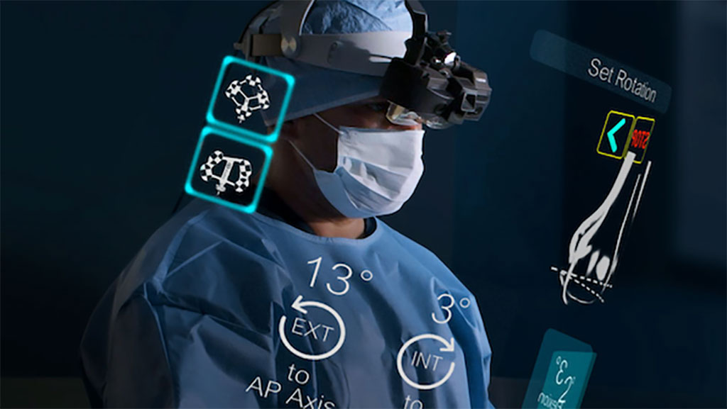 Enovis Launches ARVIS®, Only Augmented Reality Surgical Guidance System Designed Specifically to Improve Both Total Hip and Knee Replacement Surgery – OrthoFeed