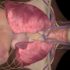 Inside Pittsburgh tech: Lumis uses augmented reality to train nurses