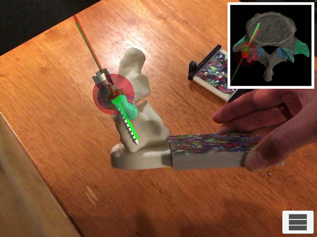 The Role of Augmented Reality in the Next Phase of Surgical... : Plastic and Reconstructive Surgery – Global Open