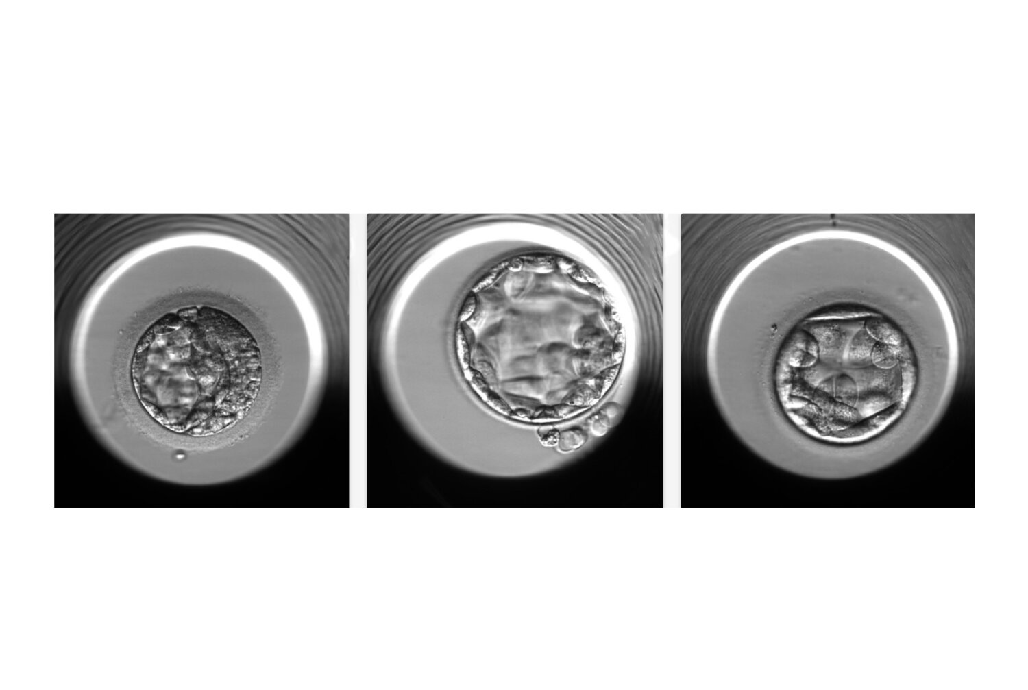 Harnessing artificial intelligence technology for IVF embryo selection