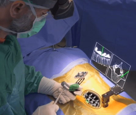 Augmedics Launches New Features, New Indications in Expansion of xvision Augmented Reality Platform -