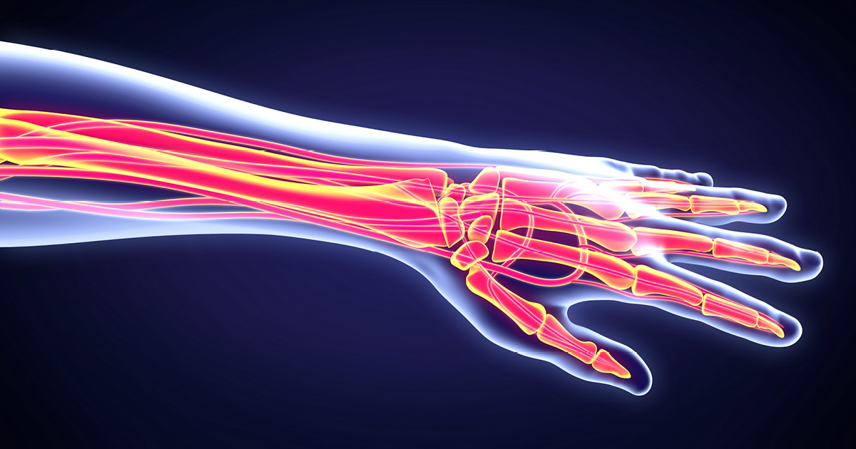 Artificial intelligence as good as other methods for documenting hand surgery cases