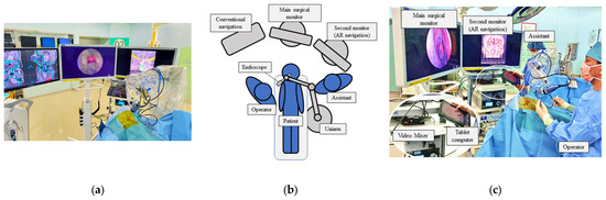 Cancers | Free Full-Text | Efficacy of a Novel Augmented Reality Navigation System Using 3D Computer Graphic Modeling in Endoscopic Transsphenoidal Surgery for Sellar and Parasellar Tumors